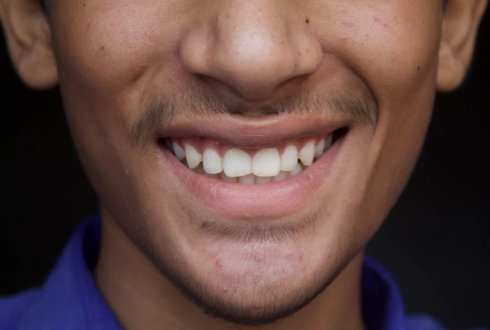 Nærbilde av en ung manns smil